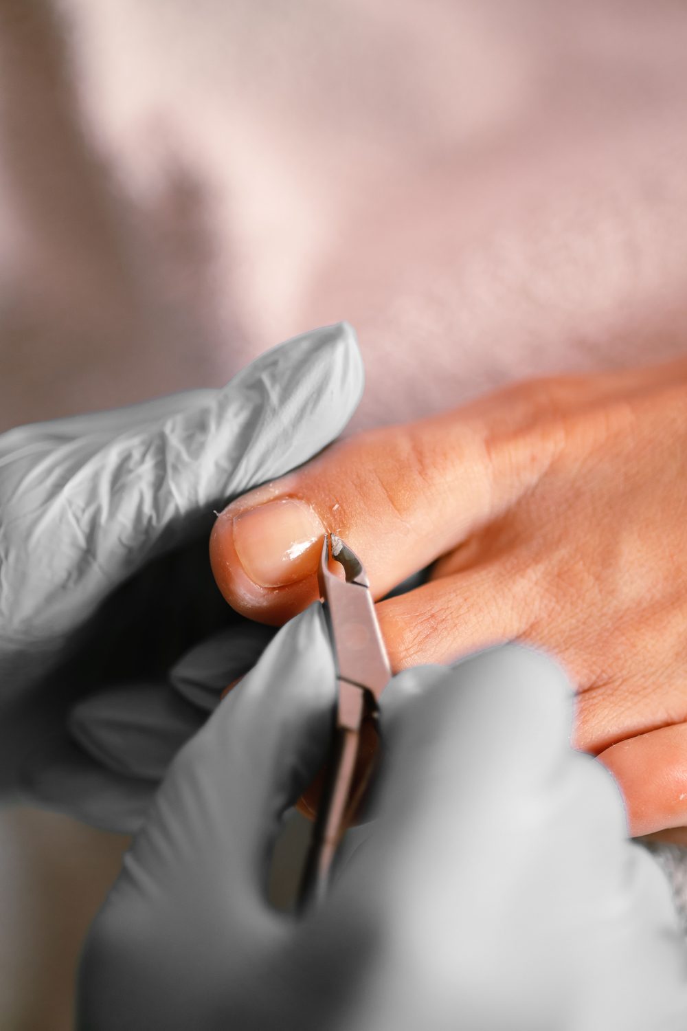 Detail van een nagelriembehandeling met steriel materiaal